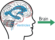 Brain Diseases Index